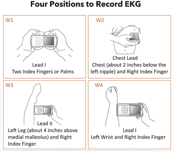 EMAY Portable ECG Monitor (for iPhone & Android, Mac & Windows) | Wireless EKG Monitoring Devices with Heart Rate & Rhythm Tracking